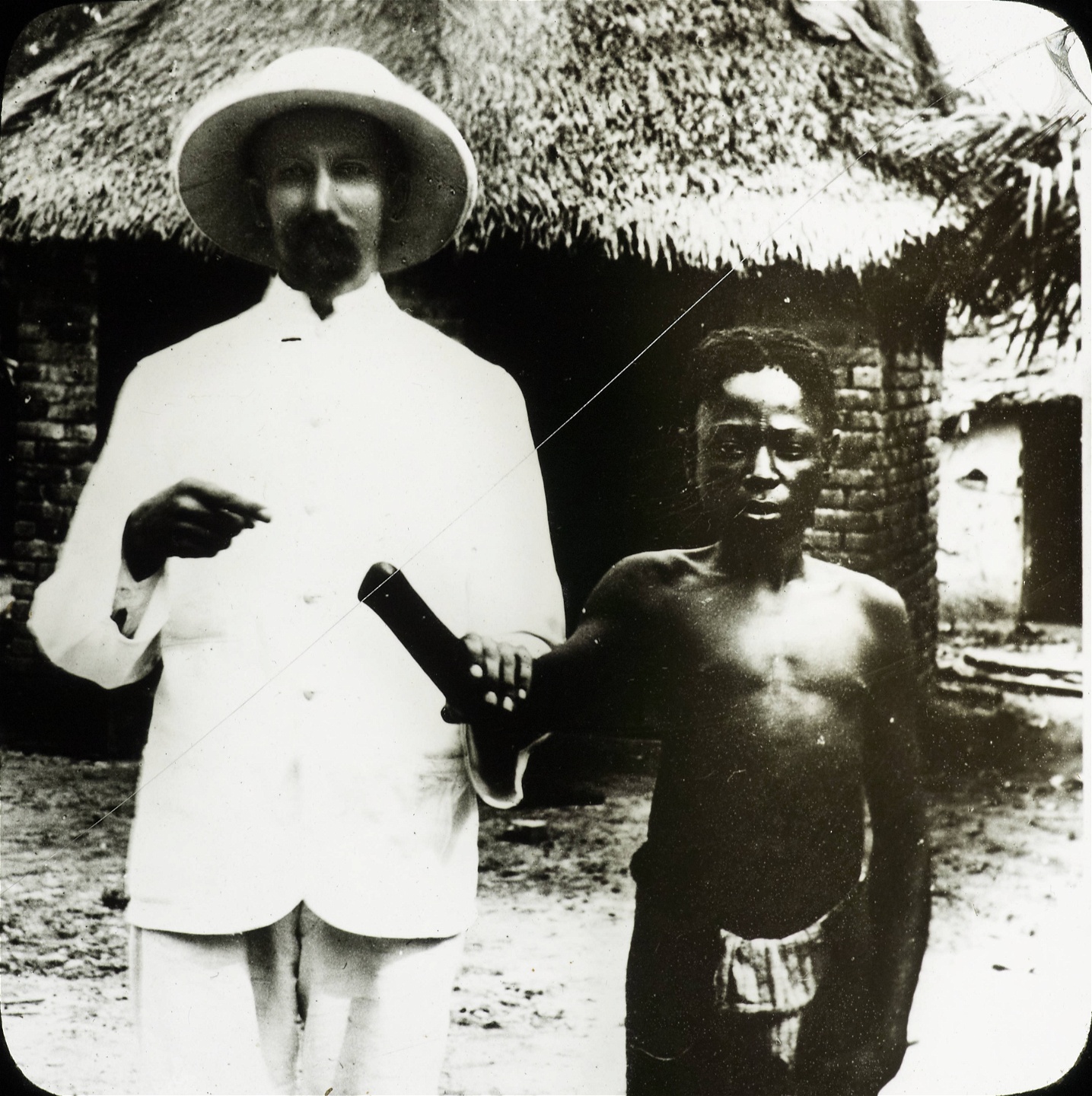 En missionär med en kongolesisk pojke som fått sin hand avhuggen, troligen för att han inte ansågs ha fullgjort sin dagskvot på gummiplantagen. Till de kongolesiska församlingsmedlemmarna som utsattes för kolonialmaktens övergrepp meddelade missionärerna att det var bäst att ge soldaterna vad de begärde för att slippa få sina byar nedbrända.