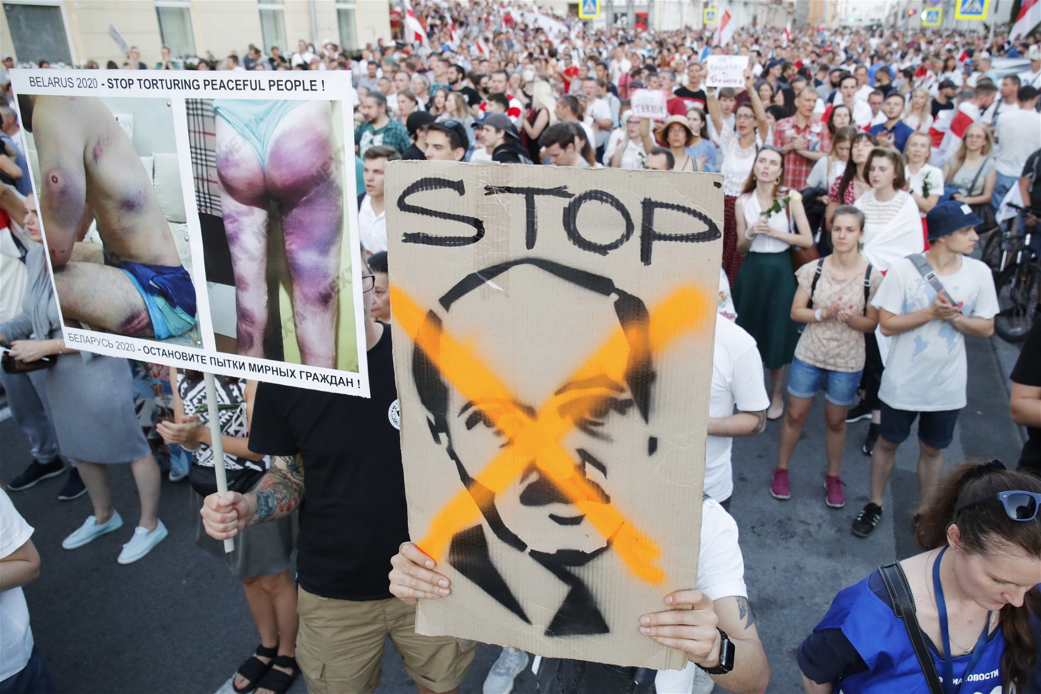 Under en demonstration den 15 augusti. Människor håller upp bilder på skador demonstranter ska ha fått vid polisingripanden. Foto: Dmitri Lovetsky/AP/TT
