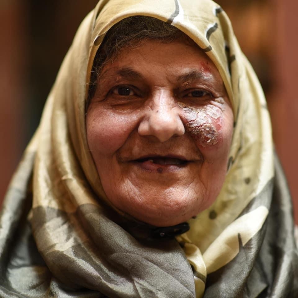 Foto: Mona BibiNabeha Abu Jamous, född 1942 i Akka i Palestina, bor i dag i Shatilalägret i Beirut. Hon deltar i podden och delger sina minnen. "Vi fick springa barfota från våra hus", berättar hon.